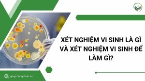 Xét nghiệm vi sinh là gì và xét nghiệm vi sinh để làm gì?